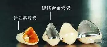 上海烤瓷牙医生