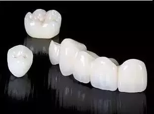 全瓷牙时间久了会有牙龈黑线吗?全瓷牙有哪些种类?