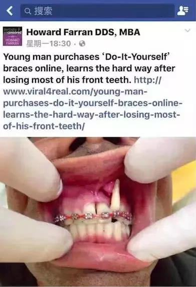 从网上买的牙齿矫正器靠谱吗