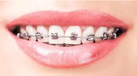 牙齿矫正对牙齿的伤害大吗?