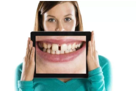 出现大龅牙，牙齿缝隙偏大等情况;做牙齿矫正有危害吗?