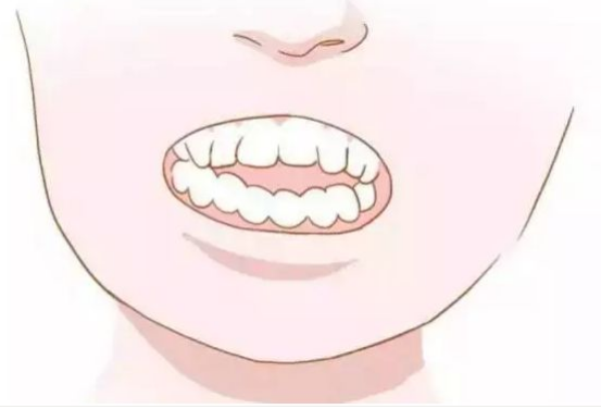 矫正期间牙齿松动正常吗?什么原因导致松动？