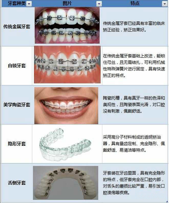 上海儿童箍牙价格是多少
