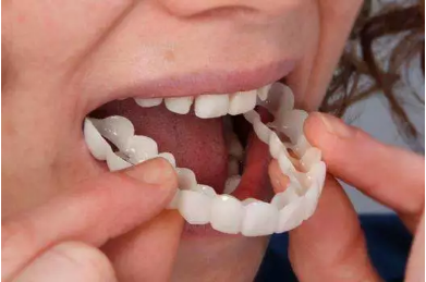 牙齿矫正的方法