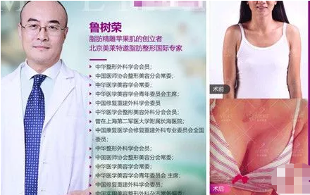 北京美莱整形医院隆胸效果自然的医生