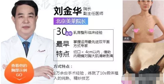 北京美莱整形医院隆胸效果自然的医生