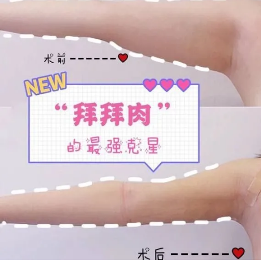 上海华美吸脂好不好?华美吸脂多少钱?