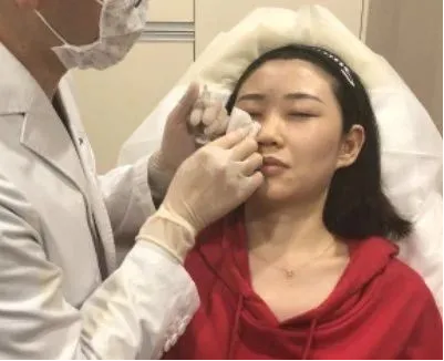 北京加减美面部提升案例