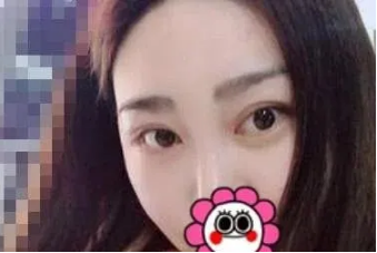 成都整形美容李静如何？医生个人介绍附赠吸脂案例