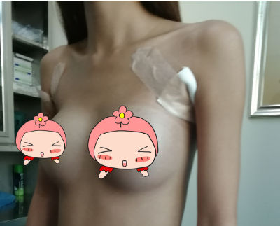 北京联合丽格杨大平做假体隆胸