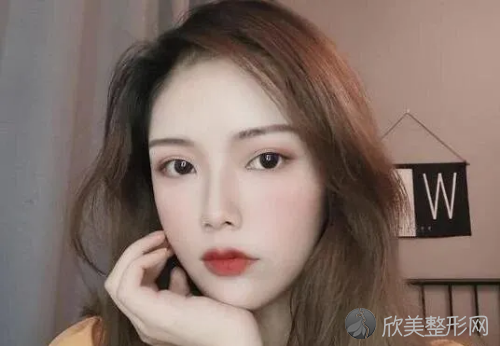 北京京民郭建玲做双眼皮技术好不好