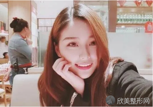 北京京民郭建玲做双眼皮技术好不好