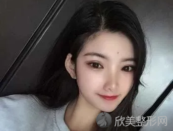北京新星靓整形技术靠谱吗