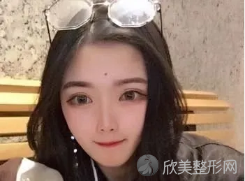 北京新星靓整形技术靠谱吗