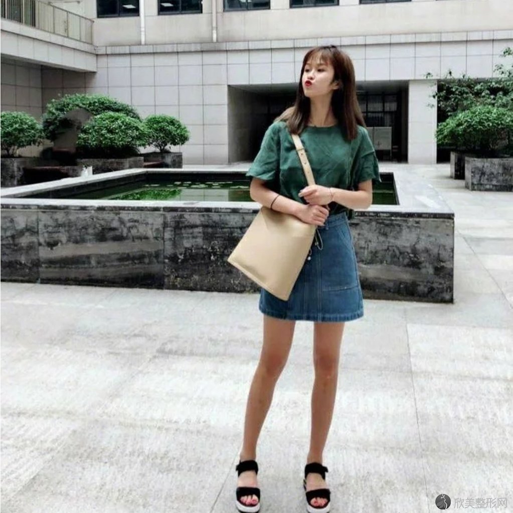 上海长海医院整形外科邢新吸脂手术案例