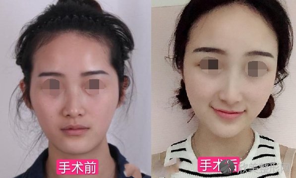 上海韩镜医疗美容医院李科做脂肪移植怎么样？让你的身材更加棒