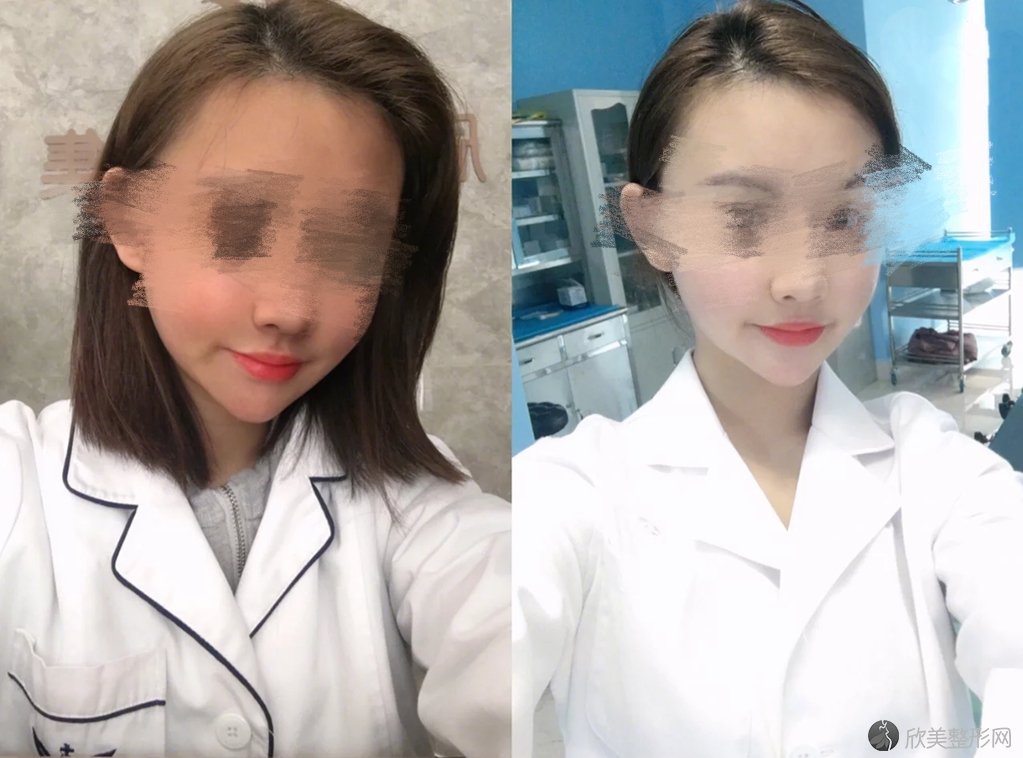 上海薇琳医疗美容医院王中秒做注*美容怎么样？案例,预约时间