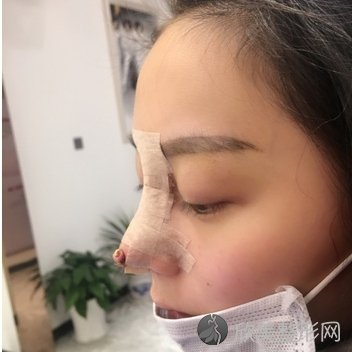上海复美医疗美容门诊部于晓萍案例