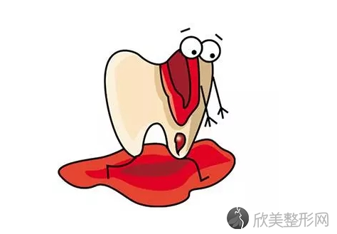 牙龈炎和牙周炎的区别 