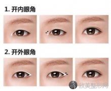 开内眼角术前术后有哪些需要注意的事项？求科普~