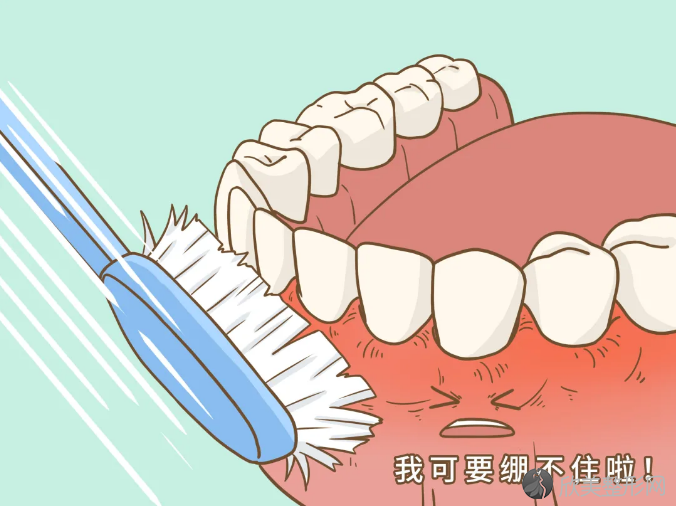 牙龈发炎图片