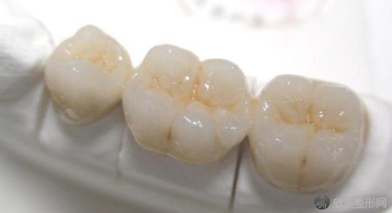 <a href='https://www.joshreso.com/yidong/' target='_blank'><u>牙齿整形</u></a>