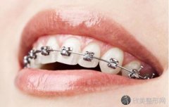 浙江省口腔医院做牙齿方面的治疗需要花多少钱？