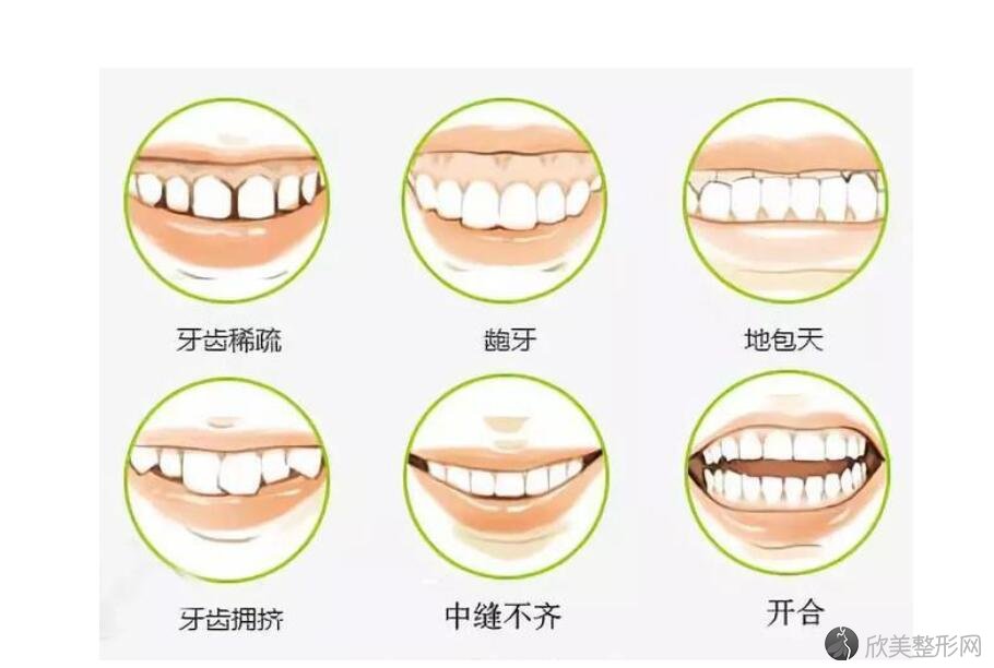 牙齿矫正