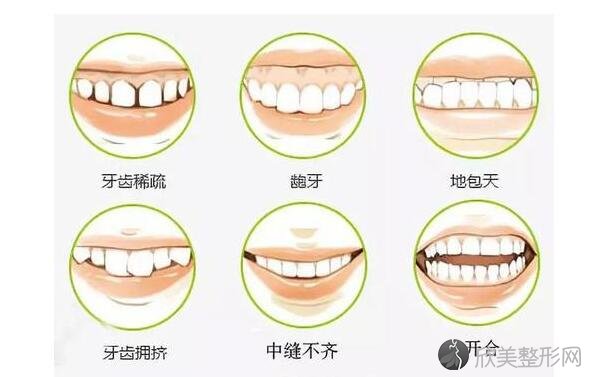 牙齿矫正