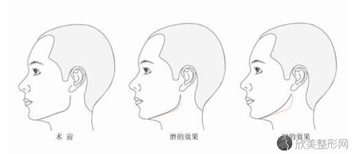 下颌角