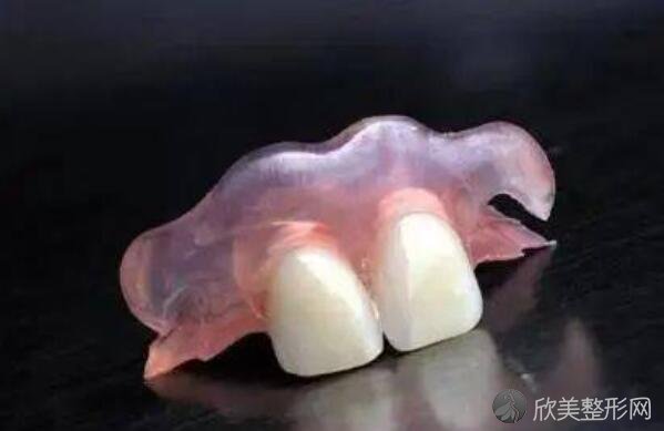 临时活动假牙能戴多久 起到的作用是什么呢 欣美整形