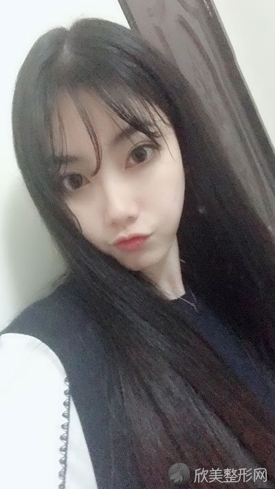 术后60天