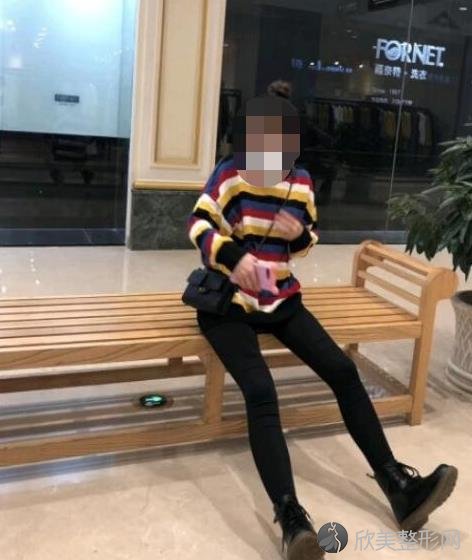 北京东方和谐整形美容医院王自谦医生做大腿吸脂之后