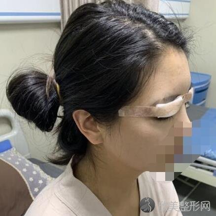 上海容妍柴云眼综合怎么样？柴云简介-双眼皮价目表