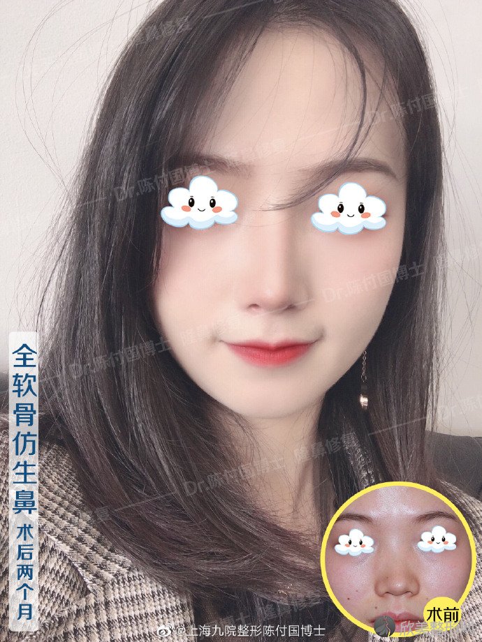 中国很难预约十大隆鼻专家 欣美整形 中国很难预约十大隆鼻专家 欣美整形