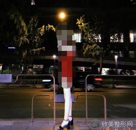 南京华美整形美容医院朱善智医生做大腿吸脂之后