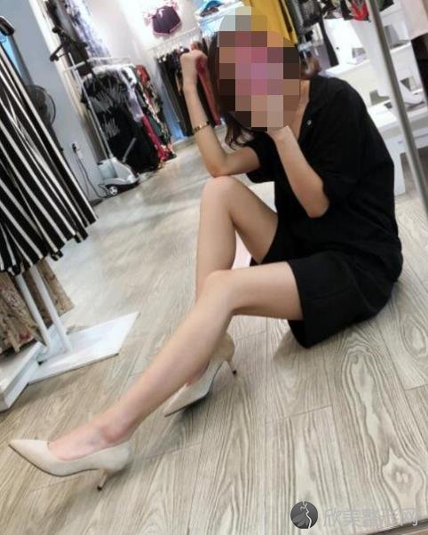 杭州美莱翟爽吸脂之后