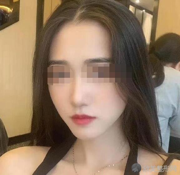 杭州星博体整形医院抽脂之后