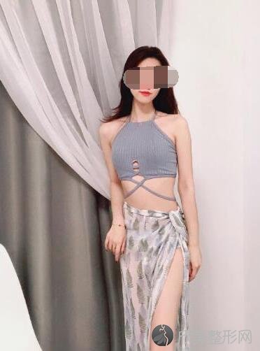 腰腹吸脂术后30天