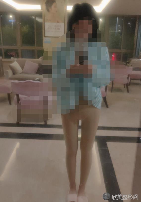 长沙安吉娜整形医院的赵福德医生做腿部吸脂之后