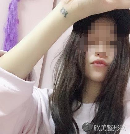 补牙之后