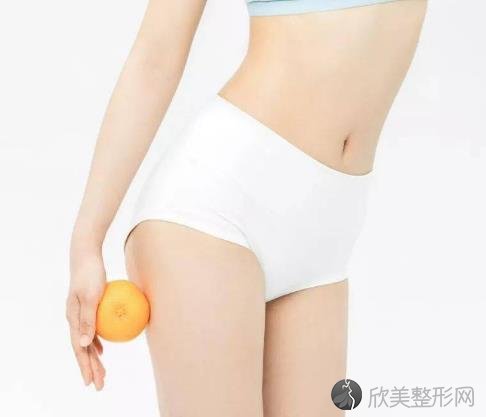 吸脂