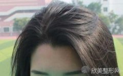 美人尖可以剃掉吗？合适美人尖的发型有哪些？