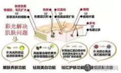 【科普】彩光嫩肤的功效和作用和护理