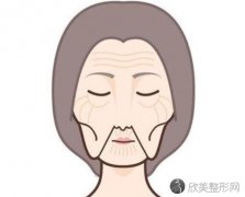嘴角皱纹形成的原因以及日常保养方式