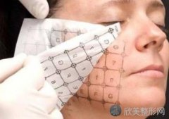浙一医院整形科分享：热玛吉紧致祛皱适合的年龄-效果-费用