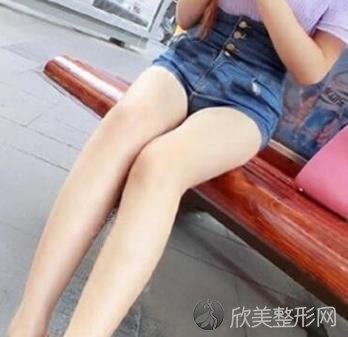 上海华山医院吸脂瘦腿案例分享，术后效果对比，腿型修长感觉太好了