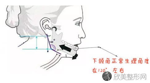 兰州嘉琳田海峰介绍做下颌角手术的特点和安全性~让你瞬间变成美丽瓜子脸