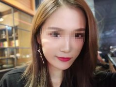 鼻子整形后可以永久保持吗
