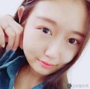眉佳整容吸脂案 你不爱精致的小脸吗？